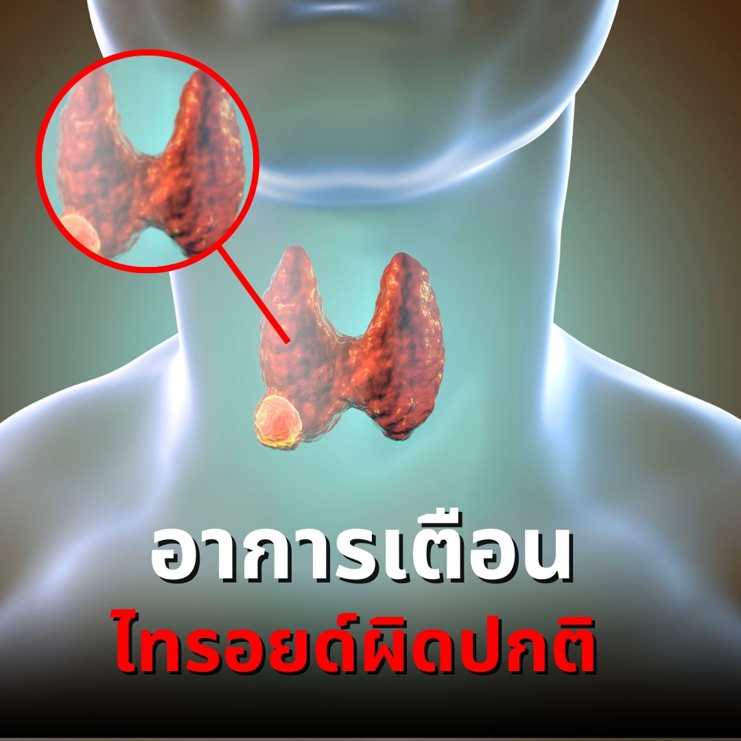 อาการเตือนไทรอยด์ผิดปกติ
